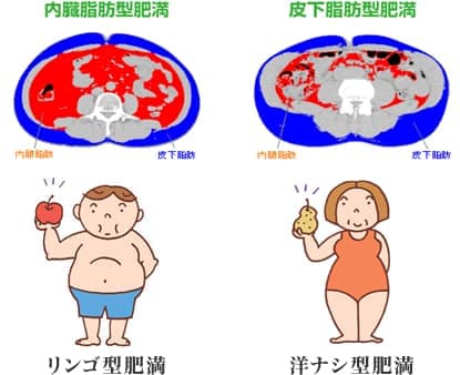 ＣＴ検査による内臓脂肪面積(下図赤色の部分)が100cm2以上になると内臓脂肪型肥満