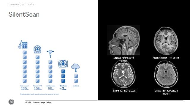 頭部MRI・MRAのサイレント（静音）技術