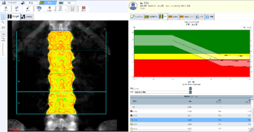 TBSレポートサンプル